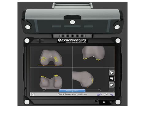 ExactechGPS Knee Applications