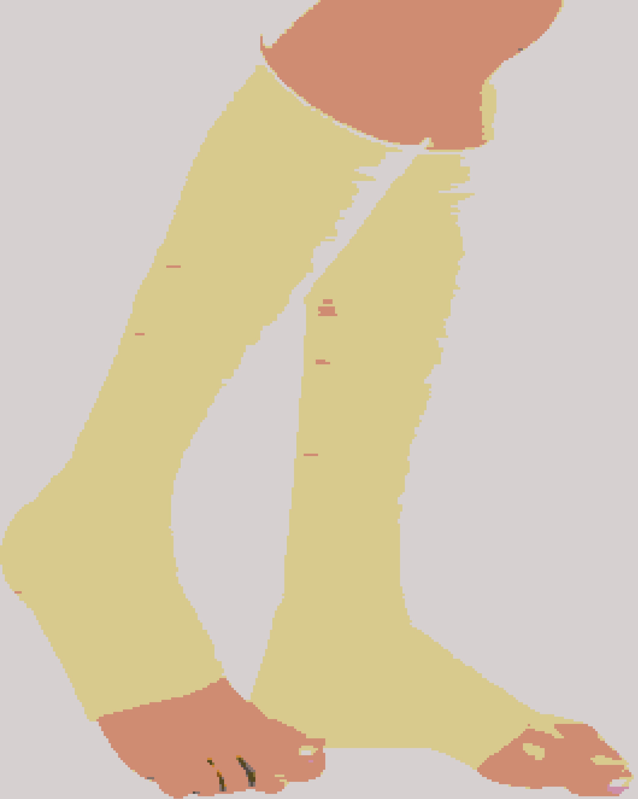 Varicose Vein Below Knee