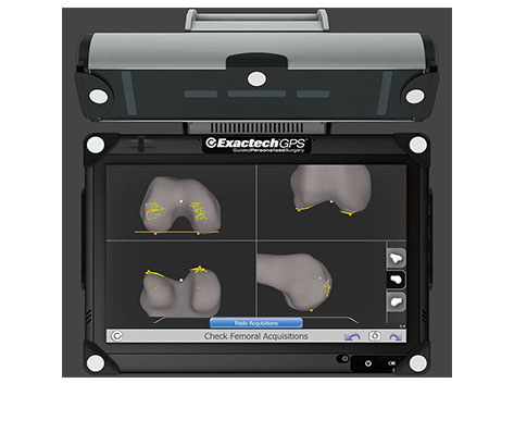 ExactechGPS Knee Applications