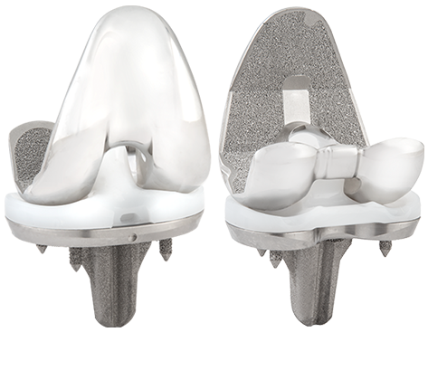 Truliant Porous Knee