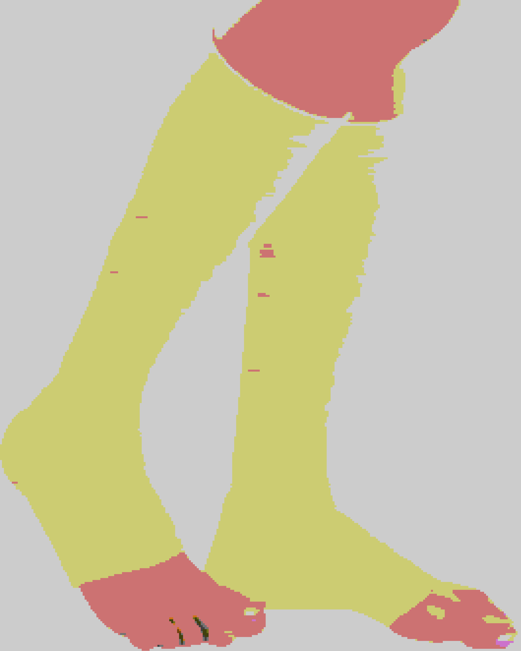 Varicose Vein Below Knee